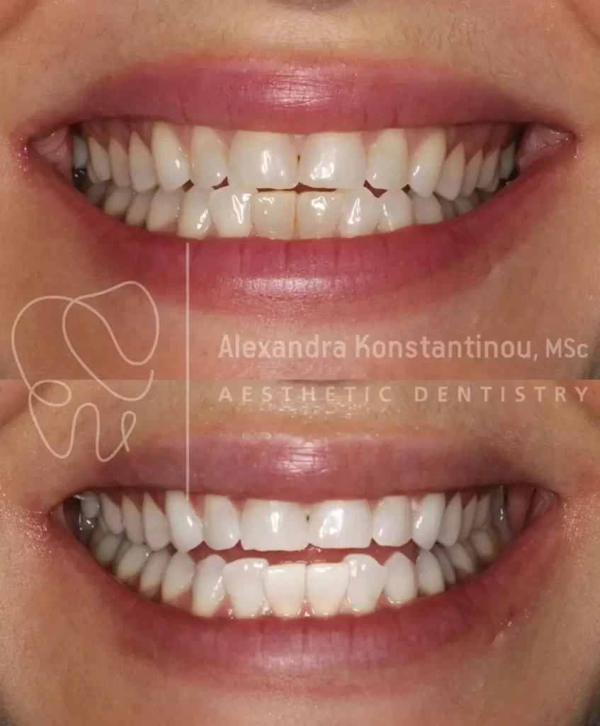 Getattachmentthumbnail 4 1 1