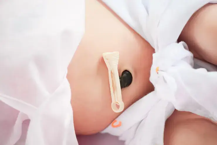 Περιτύλιξη ομφάλιου λώρου: Αιτίες, κίνδυνοι και αποτελεσματικές στρατηγικές πρόληψης